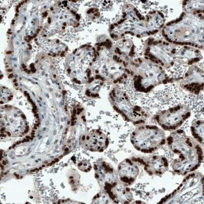Immunohistochemistry-Paraffin: ATF3 Antibody (CL1685) [NBP2-34489]
