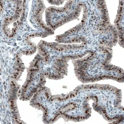 Immunohistochemistry-Paraffin: ATF3 Antibody (CL1685) [NBP2-34489]