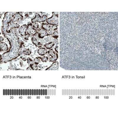 Immunohistochemistry-Paraffin: ATF3 Antibody (CL1685) [NBP2-34489]