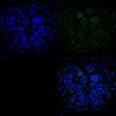 Immunocytochemistry/ Immunofluorescence: ATF3 Antibody [NBP1-85816]