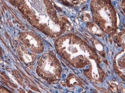 Immunohistochemistry: ATF3 Antibody - BSA Free [NBP1-02935]