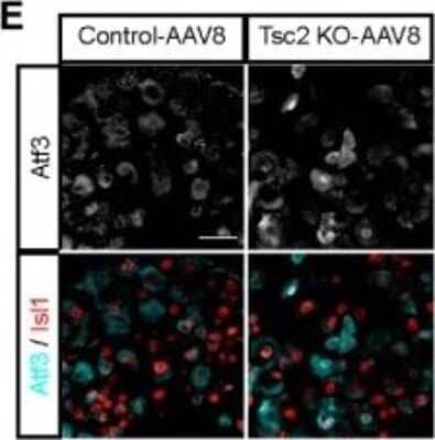 Immunohistochemistry: ATF3 Antibody [NBP1-85816]