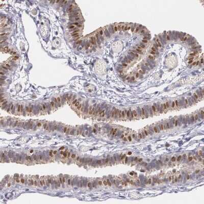 Immunohistochemistry-Paraffin: ATF3 Antibody [NBP1-85816]