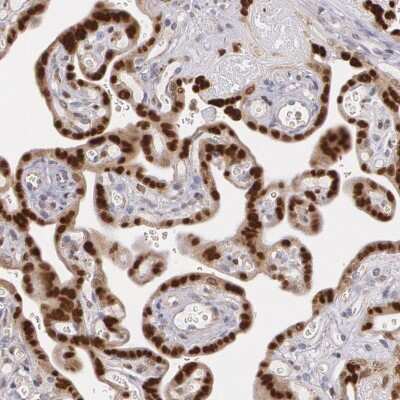 Immunohistochemistry-Paraffin: ATF3 Antibody [NBP1-85816]