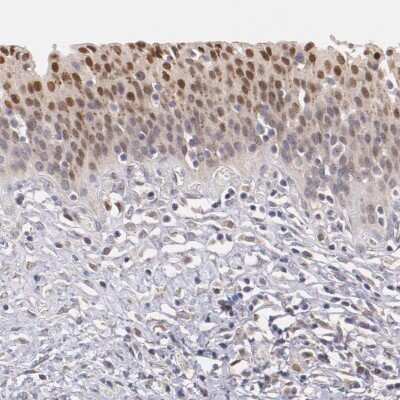 Immunohistochemistry-Paraffin: ATF3 Antibody [NBP1-85816]