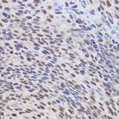 Immunohistochemistry-Paraffin: ATF3 Antibody - BSA Free [NBP2-92616]