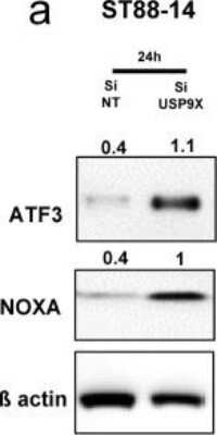 Western Blot: ATF3 Antibody [NBP1-85816]