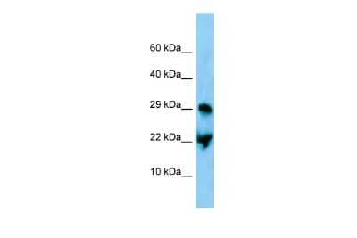 Western Blot: ATF3 Antibody [NBP2-87049]