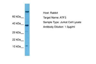 Western Blot: ATF3 Antibody [NBP2-87050]