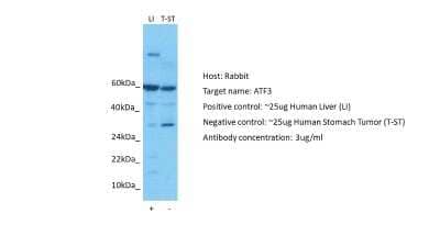 Western Blot: ATF3 Antibody [NBP2-87050]