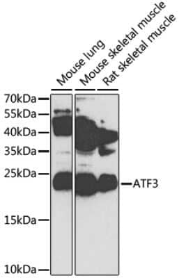 Western Blot: ATF3 AntibodyBSA Free [NBP2-92402]