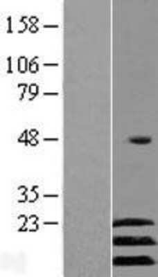 Western Blot: ATF3 Overexpression Lysate [NBP2-08185]