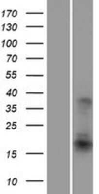 Western Blot: ATF3 Overexpression Lysate [NBP2-09216]