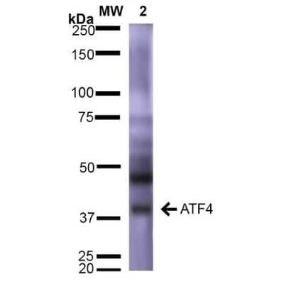 Western Blot: ATF4 Antibody (S360A-24) [NBP2-42176]