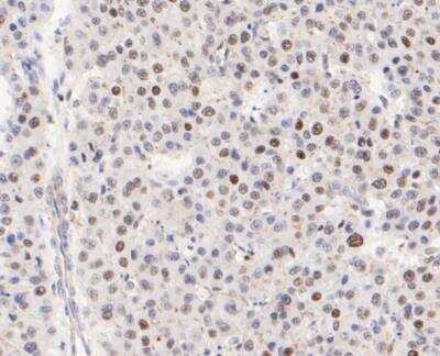 Immunohistochemistry-Paraffin: ATF4 Antibody (SD20-92) [NBP2-67766]