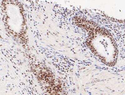 Immunohistochemistry-Paraffin: ATF4 Antibody (SD20-92) [NBP2-67766]