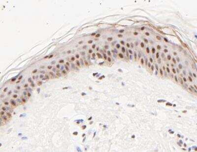 Immunohistochemistry-Paraffin: ATF4 Antibody (SD20-92) [NBP2-67766]
