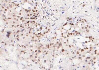 Immunohistochemistry-Paraffin: ATF4 Antibody (SD20-92) [NBP2-67766]