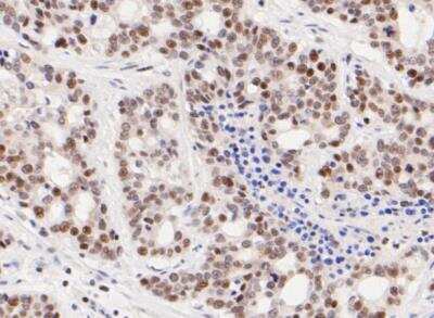 Immunohistochemistry-Paraffin: ATF4 Antibody (SD20-92) [NBP2-67766]