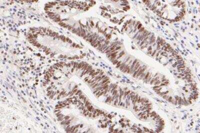 Immunohistochemistry-Paraffin: ATF4 Antibody (SD20-92) [NBP2-67766]