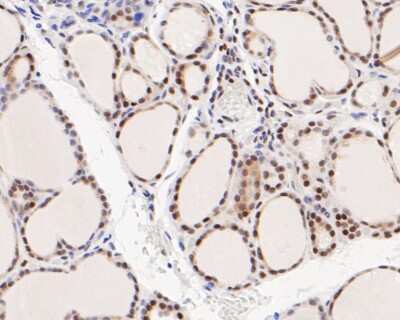 Immunohistochemistry-Paraffin: ATF4 Antibody (SD20-92) [NBP2-67766]