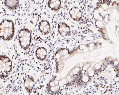 Immunohistochemistry-Paraffin: ATF4 Antibody (SD20-92) [NBP2-67766]
