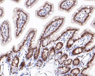 Immunohistochemistry-Paraffin: ATF4 Antibody (SD20-92) [NBP2-67766]