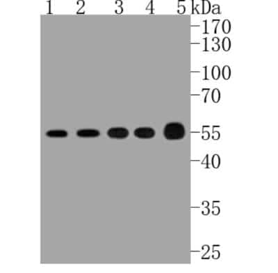 Western Blot: ATF4 Antibody (SD20-92) [NBP2-67766]