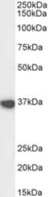 Western Blot: ATF4 Antibody [NB100-852]