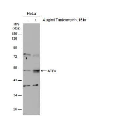 Western Blot: ATF4 Antibody [NBP2-15499]