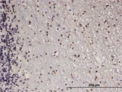 Immunohistochemistry-Paraffin: ATF5 Antibody (4G5) [H00022809-M07]