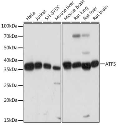 Western Blot: ATF5 Antibody (9Z3M0) [NBP3-16221]