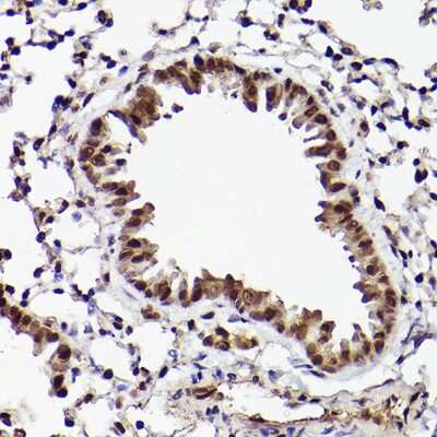 Immunohistochemistry-Paraffin: ATF5 Antibody - Azide and BSA Free [NBP2-92397]