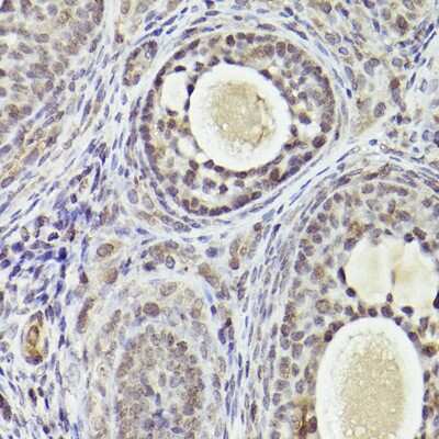 Immunohistochemistry-Paraffin: ATF5 Antibody - Azide and BSA Free [NBP2-92397]