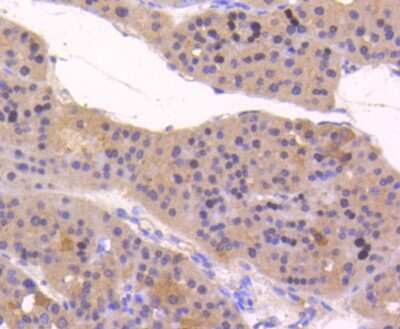 Immunohistochemistry-Paraffin: ATF5 Antibody (SD2099) [NBP2-67767]
