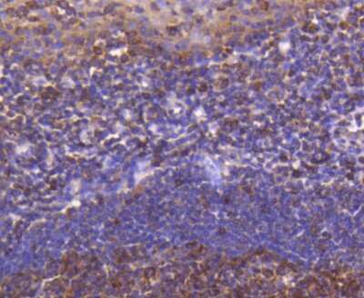 Immunohistochemistry-Paraffin: ATF5 Antibody (SD2099) [NBP2-67767]