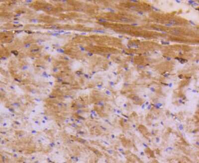 Immunohistochemistry-Paraffin: ATF5 Antibody (SD2099) [NBP2-67767]