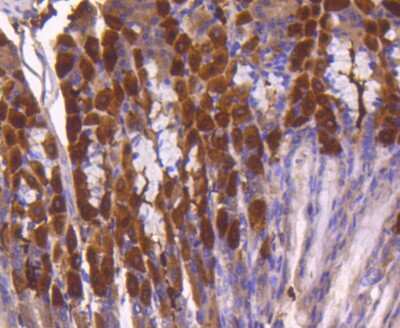 Immunohistochemistry-Paraffin: ATF5 Antibody (SD2099) [NBP2-67767]