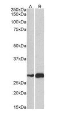 Western Blot: ATF5 Antibody [NBP1-51908]