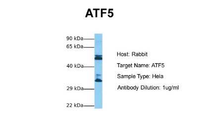 Western Blot: ATF5 Antibody [NBP3-10891]