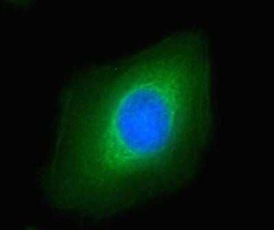 Immunocytochemistry/ Immunofluorescence: ATF6 Antibody (70B1413.1) - Azide and BSA Free [NBP2-80583]