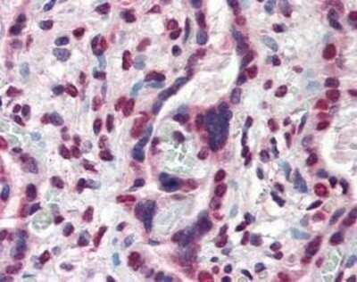 Immunohistochemistry: ATF6 Antibody (70B1413.1) - Azide and BSA Free [NBP2-80583]