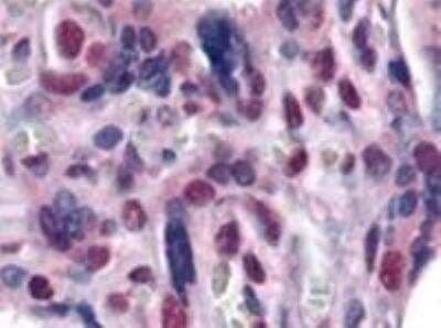 Immunohistochemistry-Paraffin: ATF6 Antibody (70B1413.1) - BSA Free [NBP1-40256]