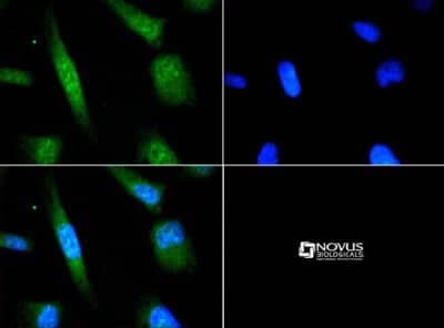 Immunocytochemistry/ Immunofluorescence: ATF6 Antibody - BSA Free [NBP1-75478]