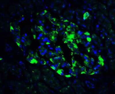 Immunocytochemistry/ Immunofluorescence: ATF6 Antibody - BSA Free [NBP1-76675]