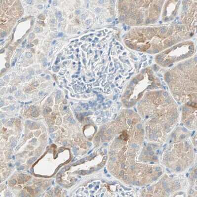 Immunohistochemistry-Paraffin: ATF6 Antibody [NBP2-48501]