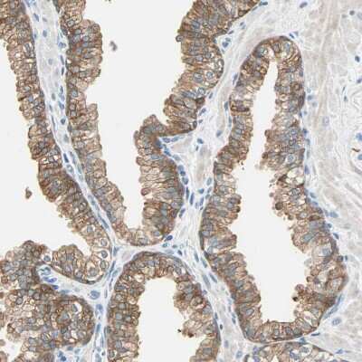 Immunohistochemistry-Paraffin: ATF6 Antibody [NBP2-48501]