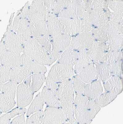 Immunohistochemistry-Paraffin: ATF6 Antibody [NBP2-48501]
