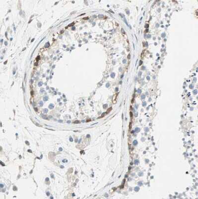 Immunohistochemistry-Paraffin: ATF6 Antibody [NBP2-48501]