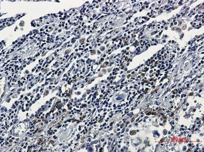 Immunohistochemistry: ATF6 Antibody (S05-4E7) [NBP3-14903]